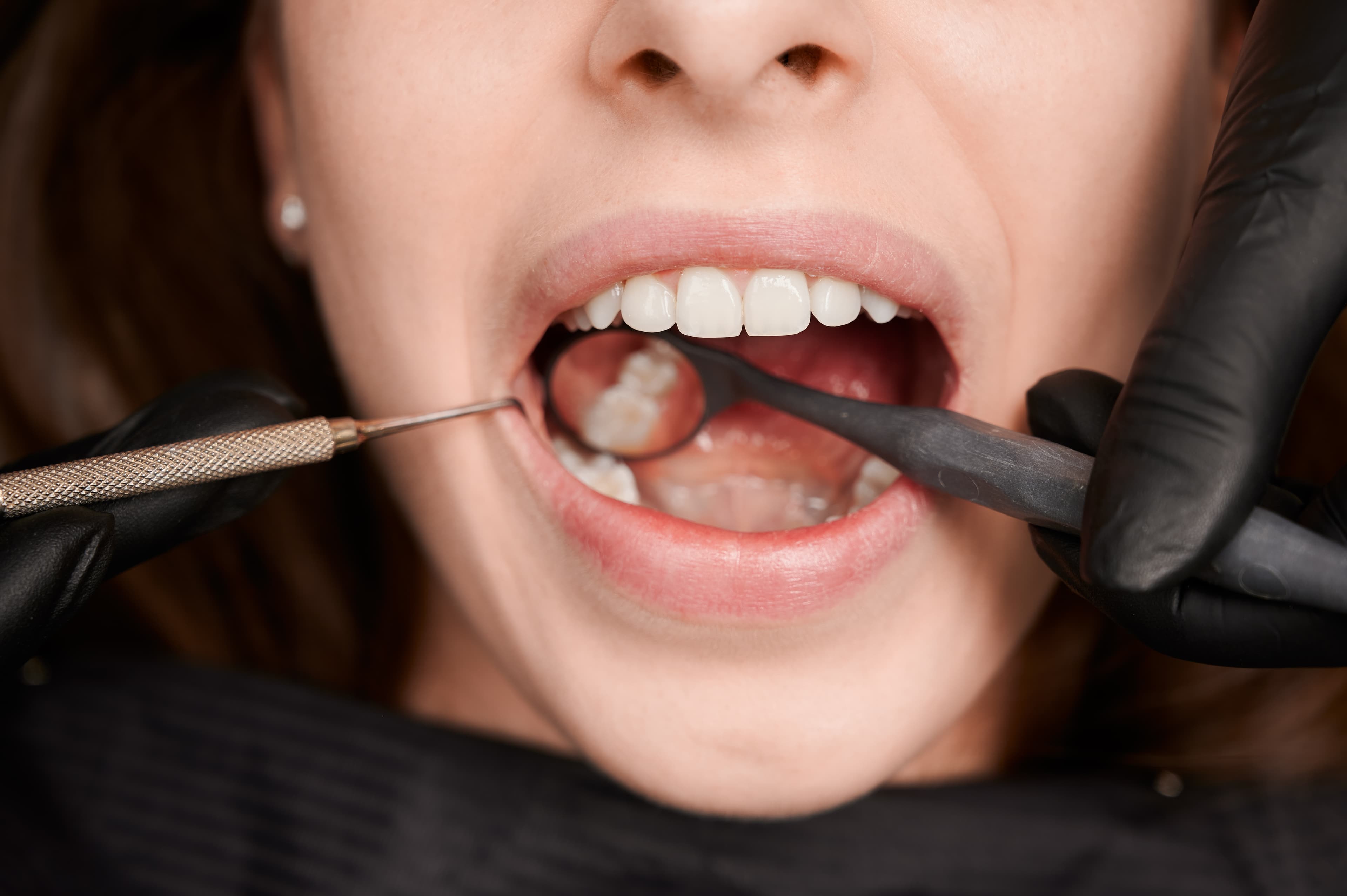 7 everyday habits that can damage your teeth
