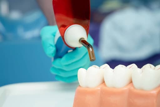 Dental Fillings vs. Dental Crowns