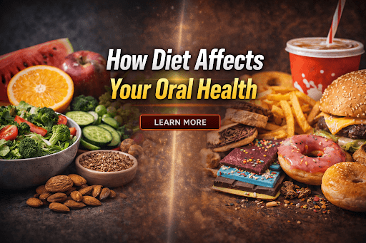 Diet Affects Your Oral Health