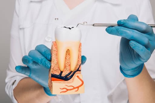 Root Canal Therapy vs Tooth Extraction