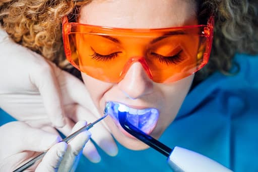 Teeth Whitening Appointment in Texas
