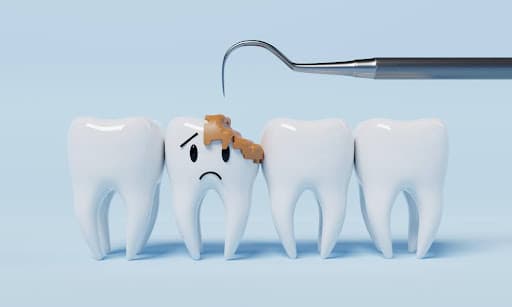 The Silent Dental Menace
