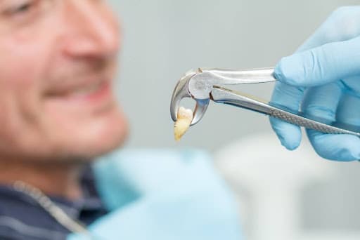 Visit-a-Dentist-Right-Away