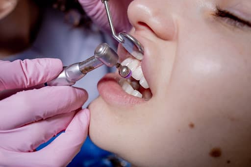 Tooth Loss After an Oral Injury