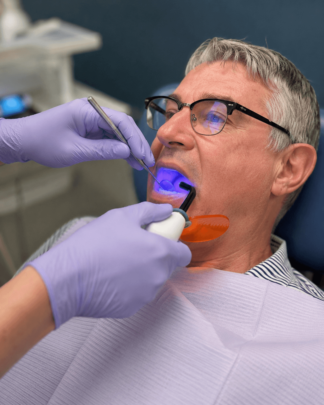 Tooth-colored fillings