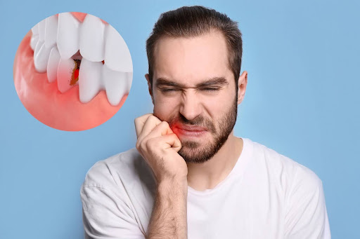 Chewing Can Trigger Tooth Sensitivity
