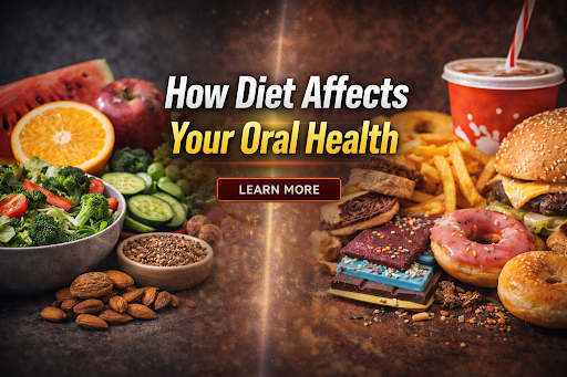 Diet Affects Your Oral Health