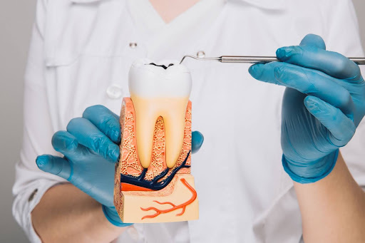 Root Canal Therapy vs Tooth Extraction