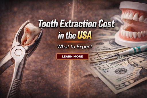 Tooth Extraction Cost in the USA
